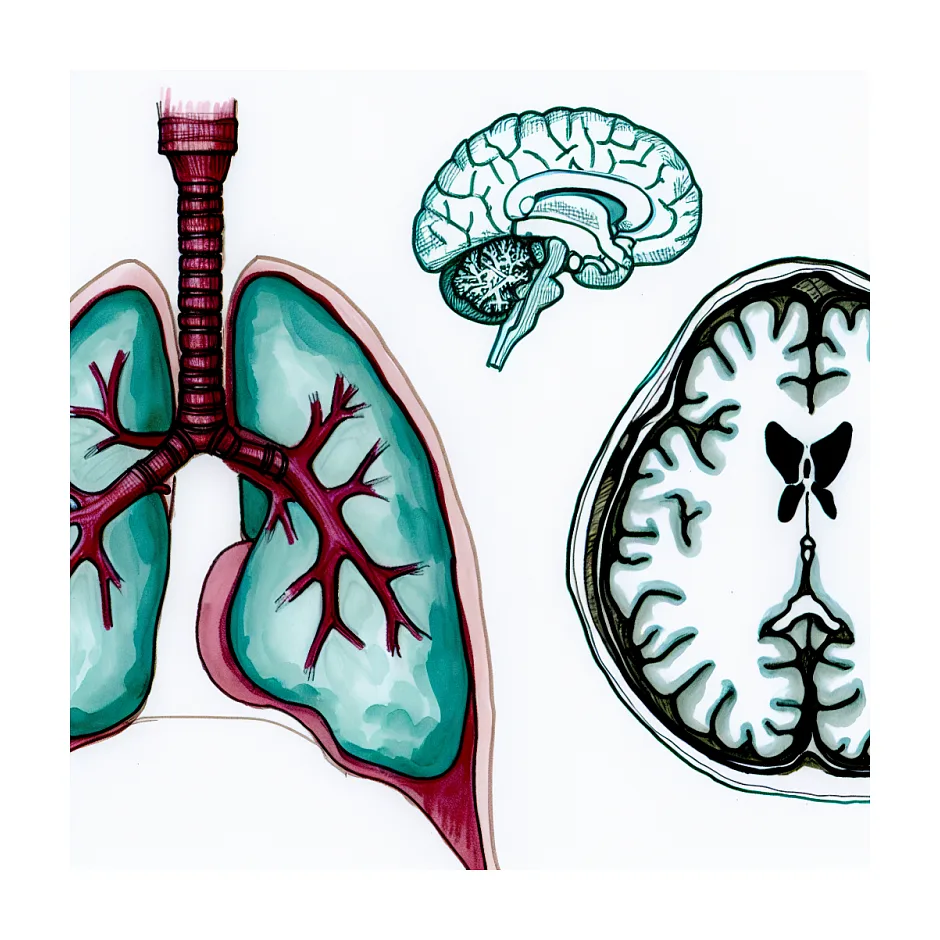 فاصله بین سی‌تی ریه و MRI مغز با ماده