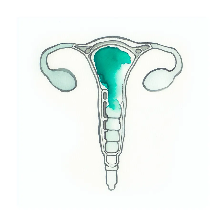 مشخصات و تاریخ انقضای IUD پرگنا TCU380A مسی