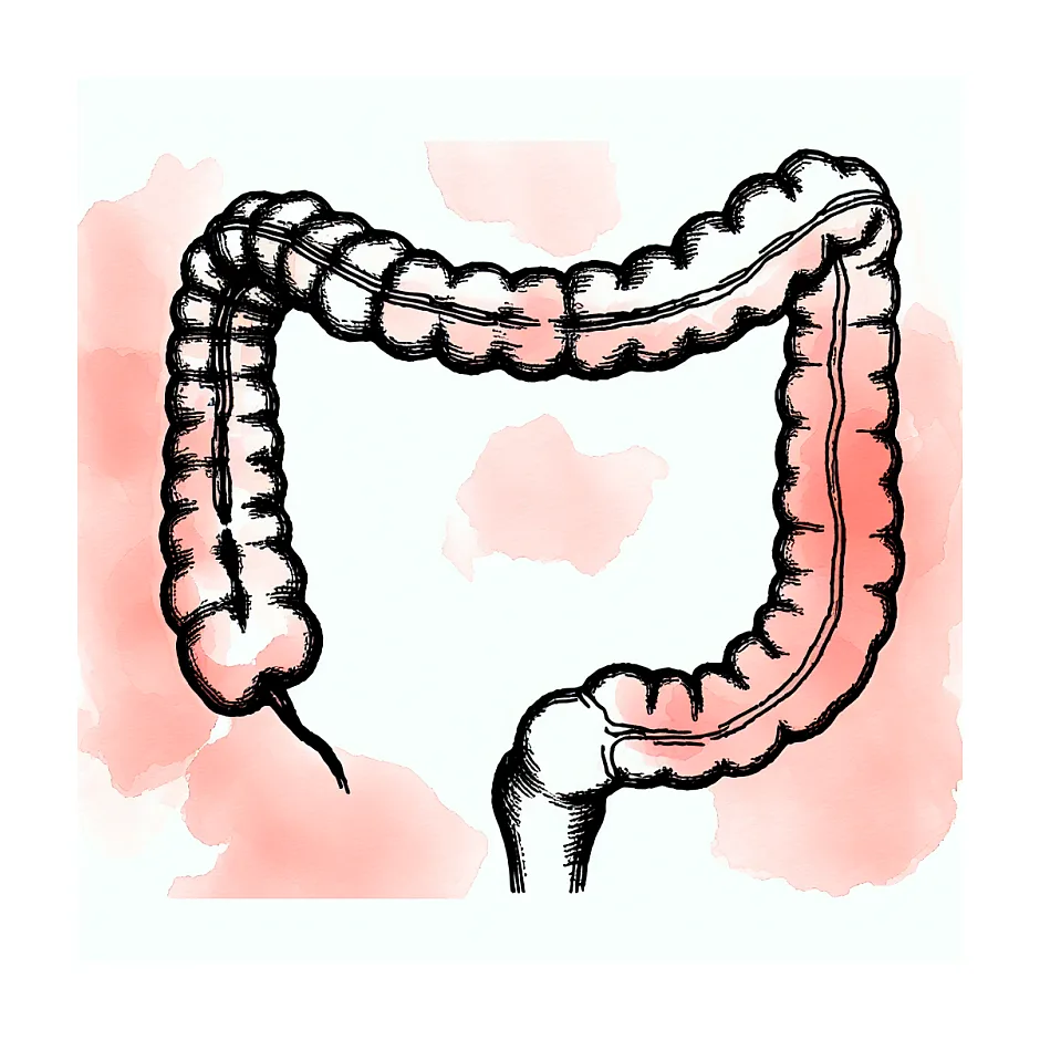 درمان متاپلازی کانونی روده ای | آموزش های پزشکی
