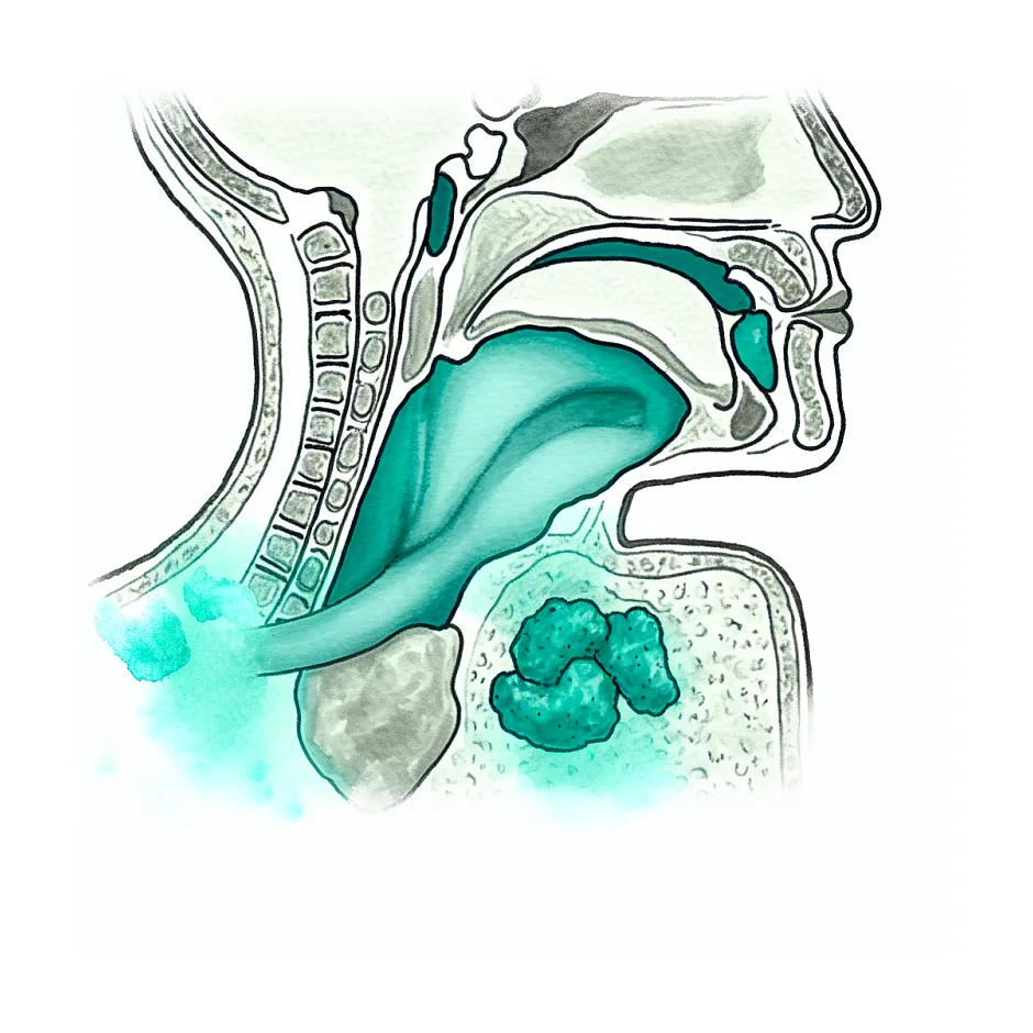 علت تیغ در گلو، خشکی و طعم ماهی در دهان