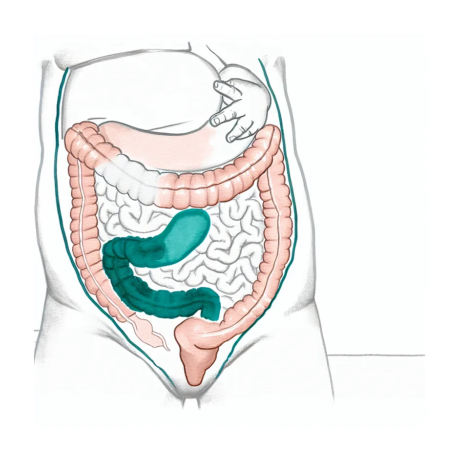 وزن‌گیری نوزاد حساس به پروتئین گاوی