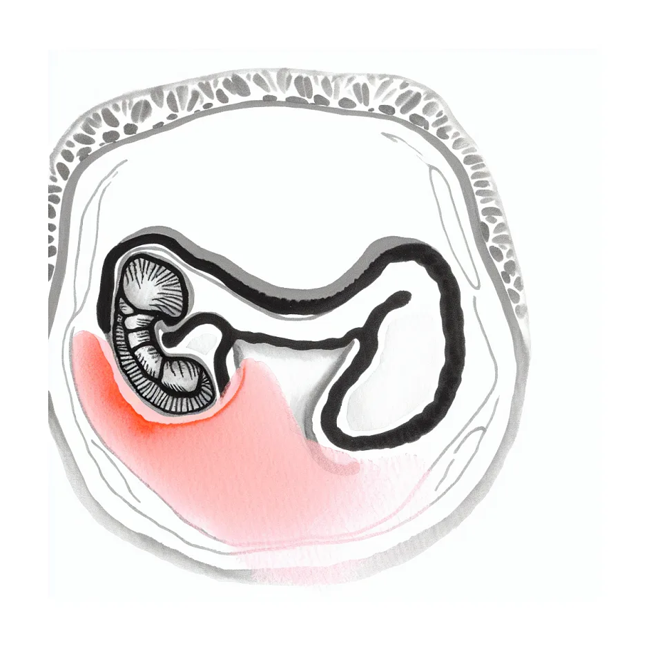 علت درد زیاد در بخیه زایمان طبیعی چیست؟