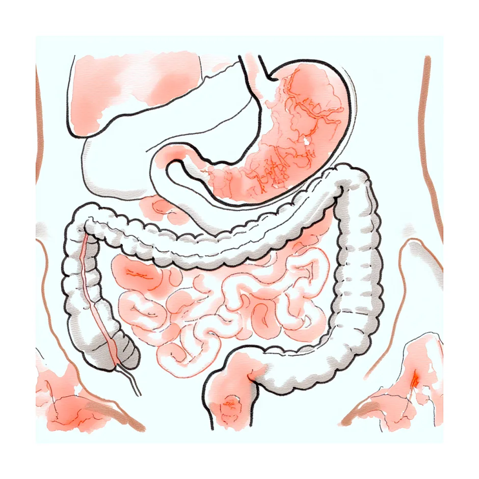 پره آپتامیل و حساسیت به پروتئین گاوی