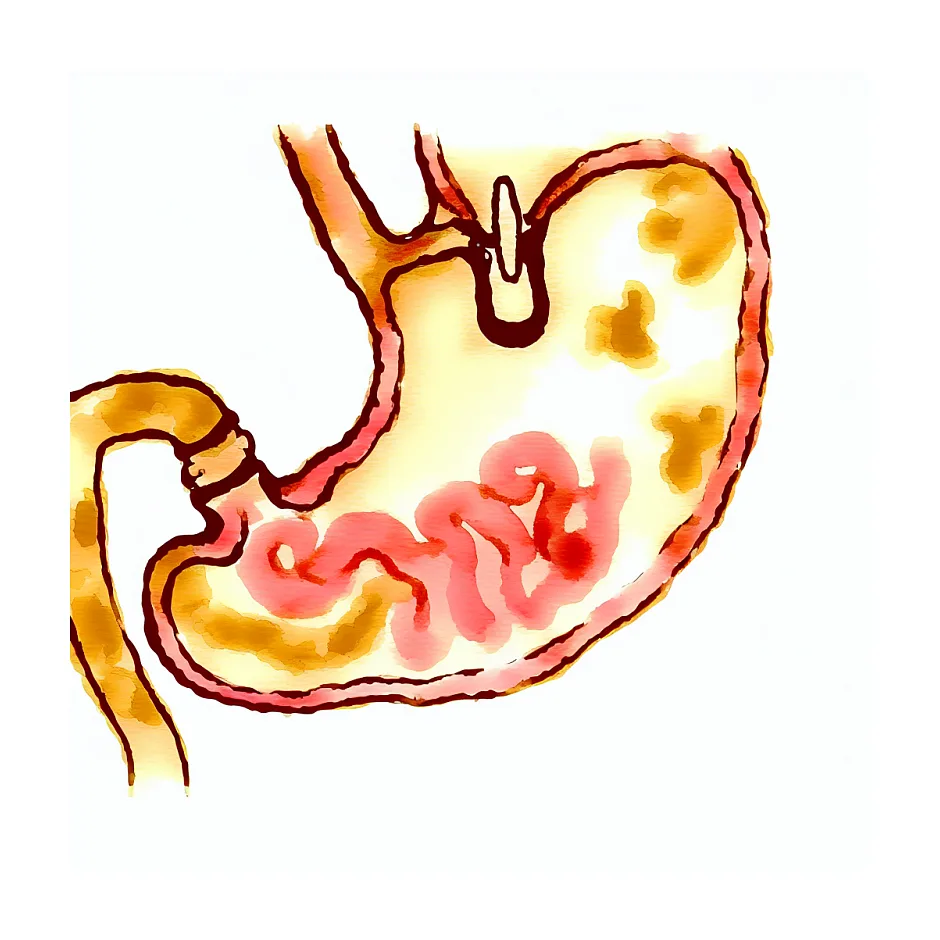 آیا استفراغ پنیری زرد در نوزاد 4 ماه طبیعی است؟