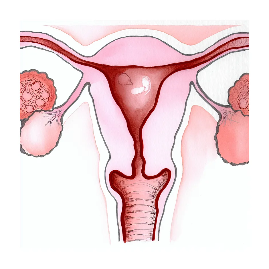 علت باردار نشدن پس از لتروزول و کلومیفن