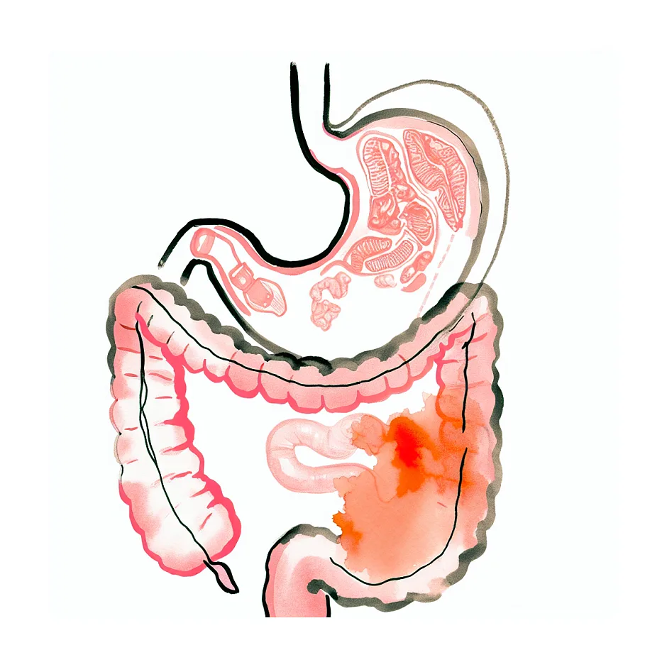 امپرازول (کیدیزول) برای نوزاد دو ماهه؛ چه باید کرد؟
