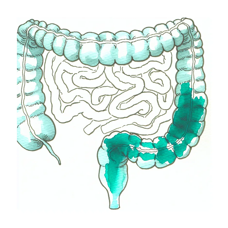 داروی مناسب یبوست و نفخ در IBS