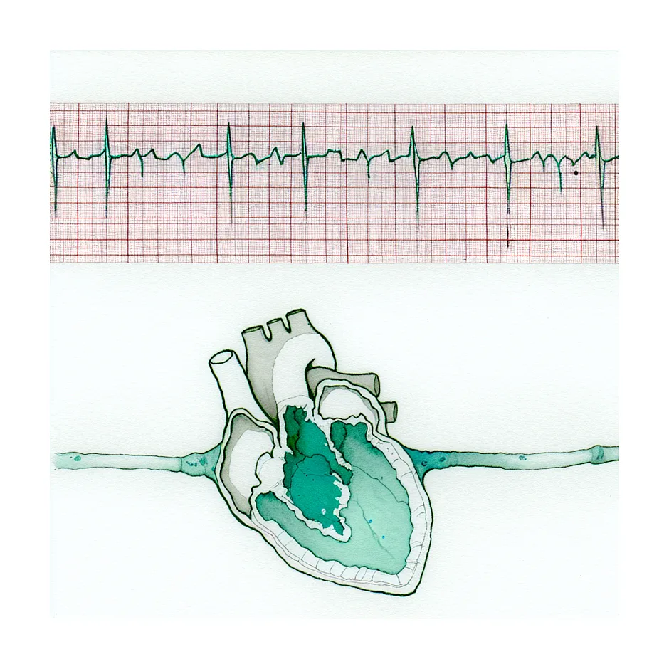 تفسیر نوار قلب Borderline Abnormal ECG - سوالات پزشکی