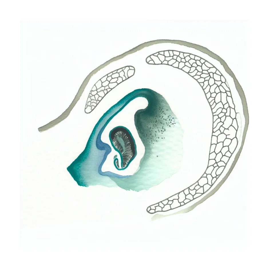 چرا ناحیه زیر بغل من به شدت عرق می‌کند؟