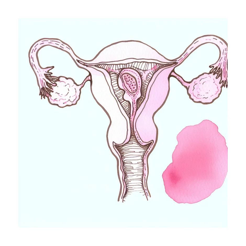 افزایش وزن در اثر مصرف کلومیفن و تخمک گذاری
