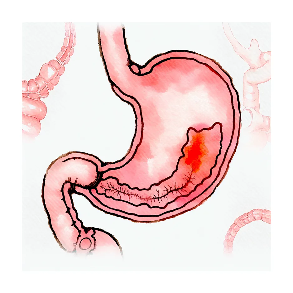 پاسخگویی به سوالات مربوط به سوزش معده و نفق - پروفسور سلامت - درمان پزشکی