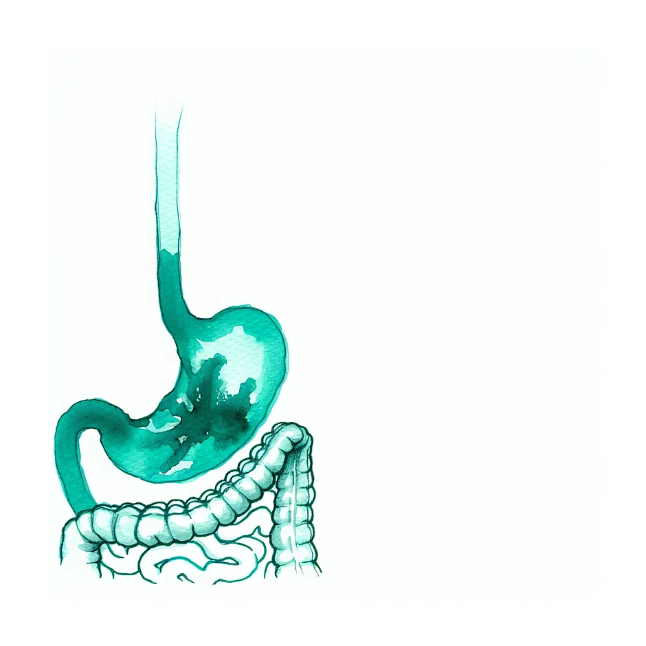رفلاکس معده - چگونه می‌توانم از رفلاکس بعد از افطار و در طول روز کمتر اذیت شوم؟