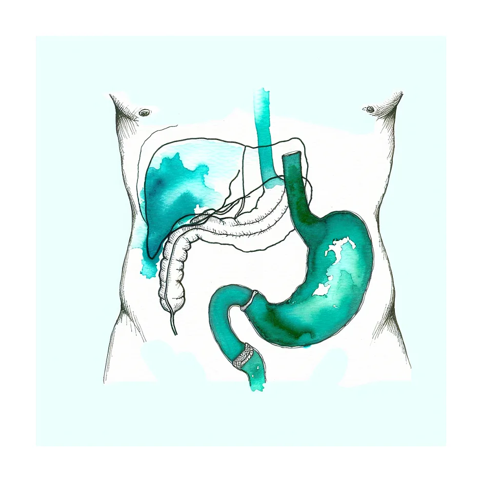 علت سنگینی شکم در ناحیه وسط مایل به چپ چیست؟