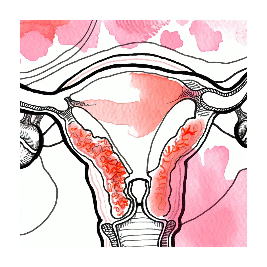 درد زیرشکم با داروهای هورمونی در مسیر IVF