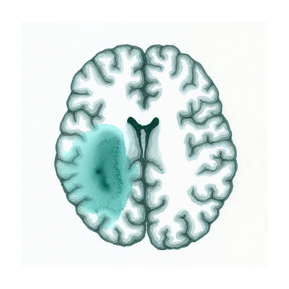 آیا لکه سفید در MRI مغز خطرناک است؟