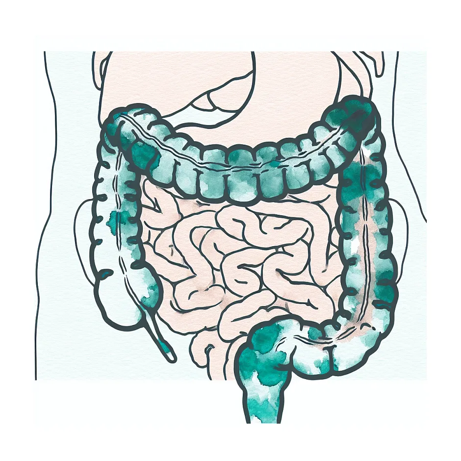 علت مدفوع مکرر بلافاصله بعد از خوردن چیست؟